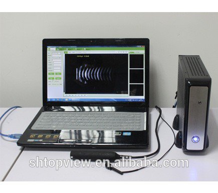 ShangLtd's tweet photo. SPA-100AP Portable Two-in-one Easy Operate Ophthalmic A Scan and Pachymeter #Ophthalmology  scan
whatsapp: 8615618732593
website: https://t.co/A7MiQwBx7y https://t.co/mS2FmVSlZx