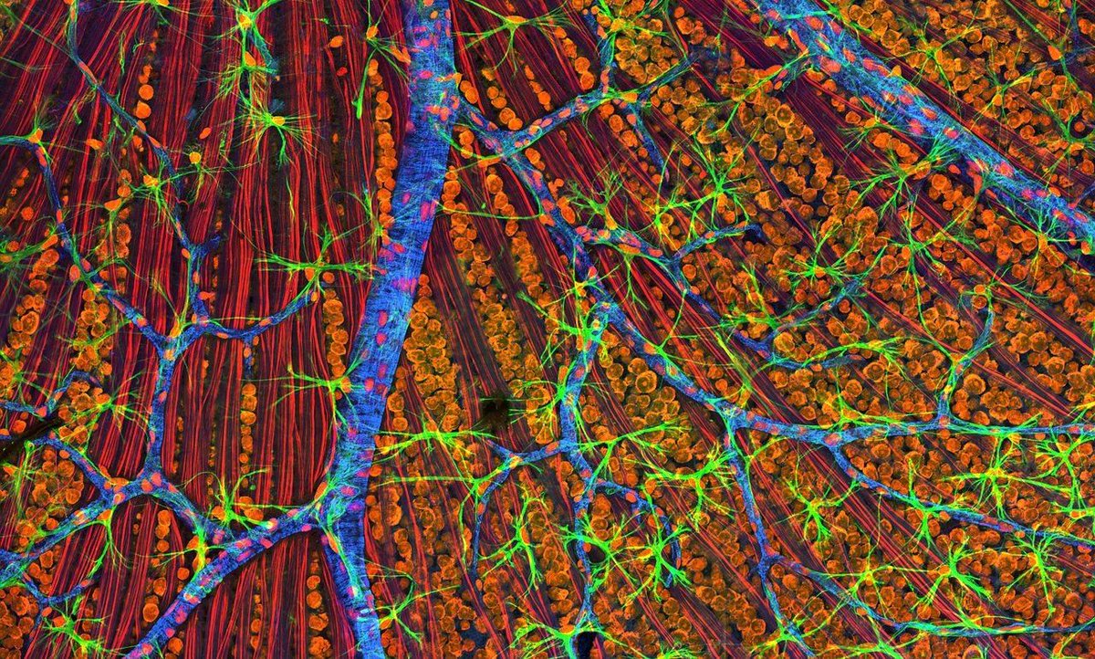 .@SernovaCorp presents #firstinhuman results from #insulin-secreting cell implant for #diabetes buff.ly/2JbaTwY