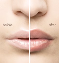 zahras's tweet photo. #MiltonKeynes Doctor led medical aesthetics in Milton Keynes and London. 

Qualified, guaranteed, safe, free consultation

Lip filler wrinkle sag nose eye jaw line crows feet

available for women and men of all ages.

https://t.co/OKswABGtVo 
safia@drsthetics.co.uk
+447376445380 https://t.co/0SDgqYkw7J