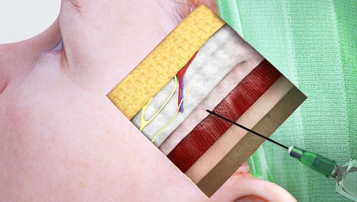 sciencestanding's tweet image. #3DAnatomyCrossSections The 3D Facial Procedures App features cross-sectional #anatomy presented with accurate 3D models that go beyond what cadaver dissections offer.

#Sciencestanding #PlasticSurgery #Ophthalmology #Dermatology #FacialRejuvenation #EyelidSurgery