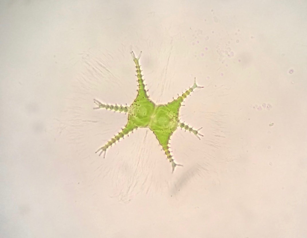 biologicabc's tweet photo. #TaxonomyThursday takes a peek at desmids, unicellular green algae characterized by symmetrical, often intricate shapes. #zeissmicroscopy https://t.co/MUXqneYCA3