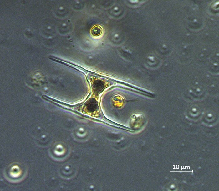 biologicabc's tweet photo. #TaxonomyThursday takes a peek at desmids, unicellular green algae characterized by symmetrical, often intricate shapes. #zeissmicroscopy https://t.co/MUXqneYCA3