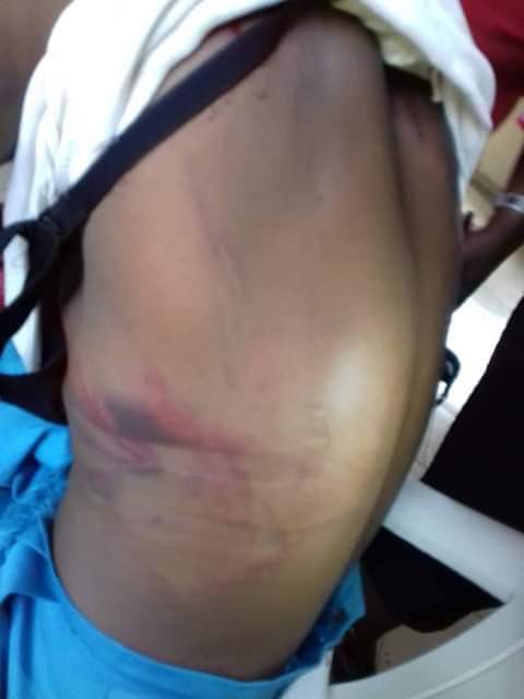 Derbyoma's tweet photo. Pls I need these pictures to go viral, this is what an Aunty did to a child that leaves with her. The child was almost raped by the aunt's brother that came to visit them, because the child cried out she was beaten beyond recognition

@Biisi96 @Chydee @yettyclassy https://t.co/msE6Jffssp