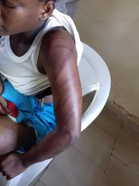 Derbyoma's tweet photo. Pls I need these pictures to go viral, this is what an Aunty did to a child that leaves with her. The child was almost raped by the aunt's brother that came to visit them, because the child cried out she was beaten beyond recognition

@Biisi96 @Chydee @yettyclassy https://t.co/msE6Jffssp