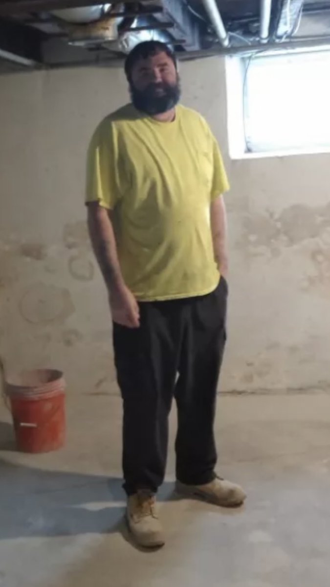 ImaginedN's tweet photo. @FroggattDaniel You talk about crack heads when you look like this gtfo LOL https://t.co/ssPzIpmOZD