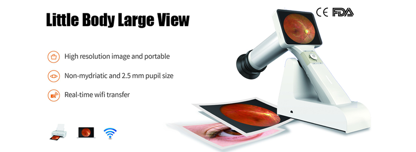 ShangLtd's tweet photo. #Ophthalmic portable #fundus-camera https://t.co/a5x54SfECf