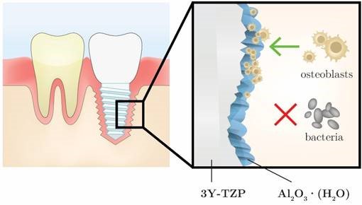 Nova #objava #K7
Nanoroughening of sandblasted 3Y-TZP surface by alumina coating deposition for improved osseointegration and bacteria reduction.
sciencedirect.com/science/articl… …