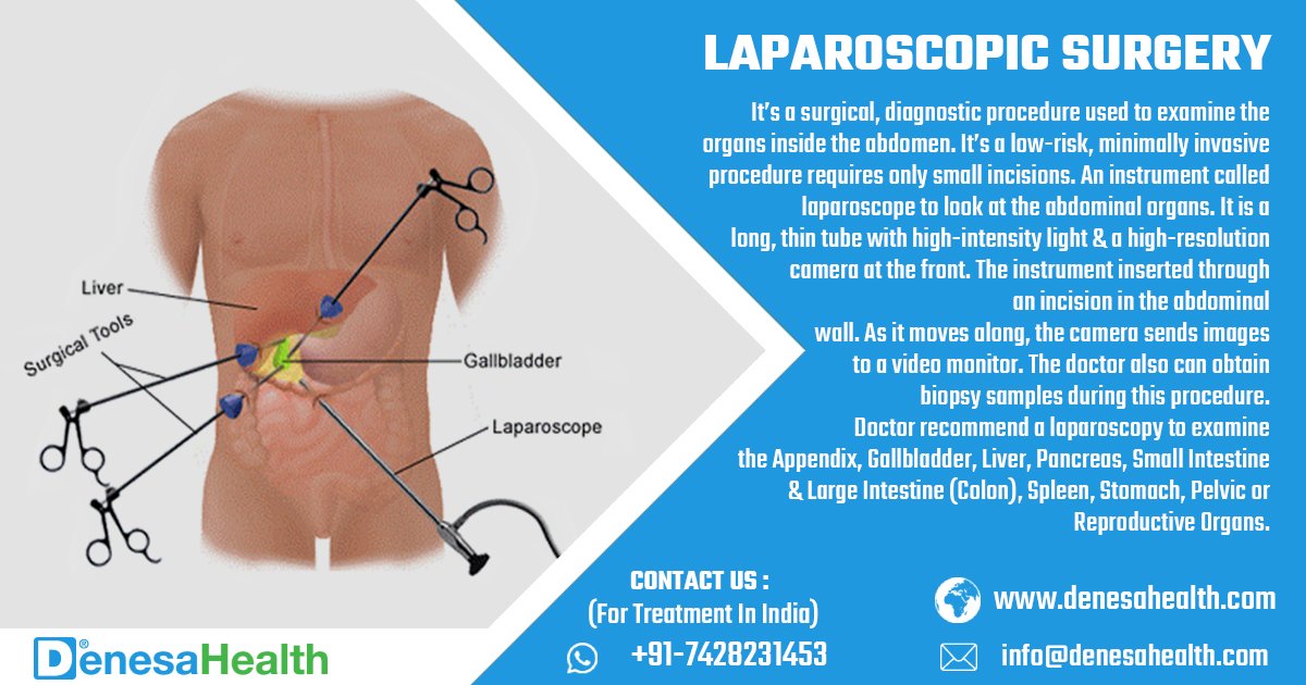 #LaparoscopicSurgery:
Its a diagnostic procedure used to examine #Organs inside the abdomen.

#AbdominalOrgans #FatRemove #HealthyOrgans #HealthTourism #MedicalTourism #DenesaHealth #Nigeria #Algeria #Morocco #Zimbabwe #Uzbekistan #Tajikistan #Afghanistan #Izmir #Ankara #Turkey