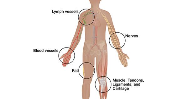 theNCI's tweet photo. Soft tissue #sarcoma is a broad term for cancers that start in soft tissues, such as muscle, tendons, and fat. These cancers are found mostly in the arms, legs, chest, and abdomen: https://t.co/OFcbLNyeDk #sarcomaawareness https://t.co/h1iW7gjtqr
