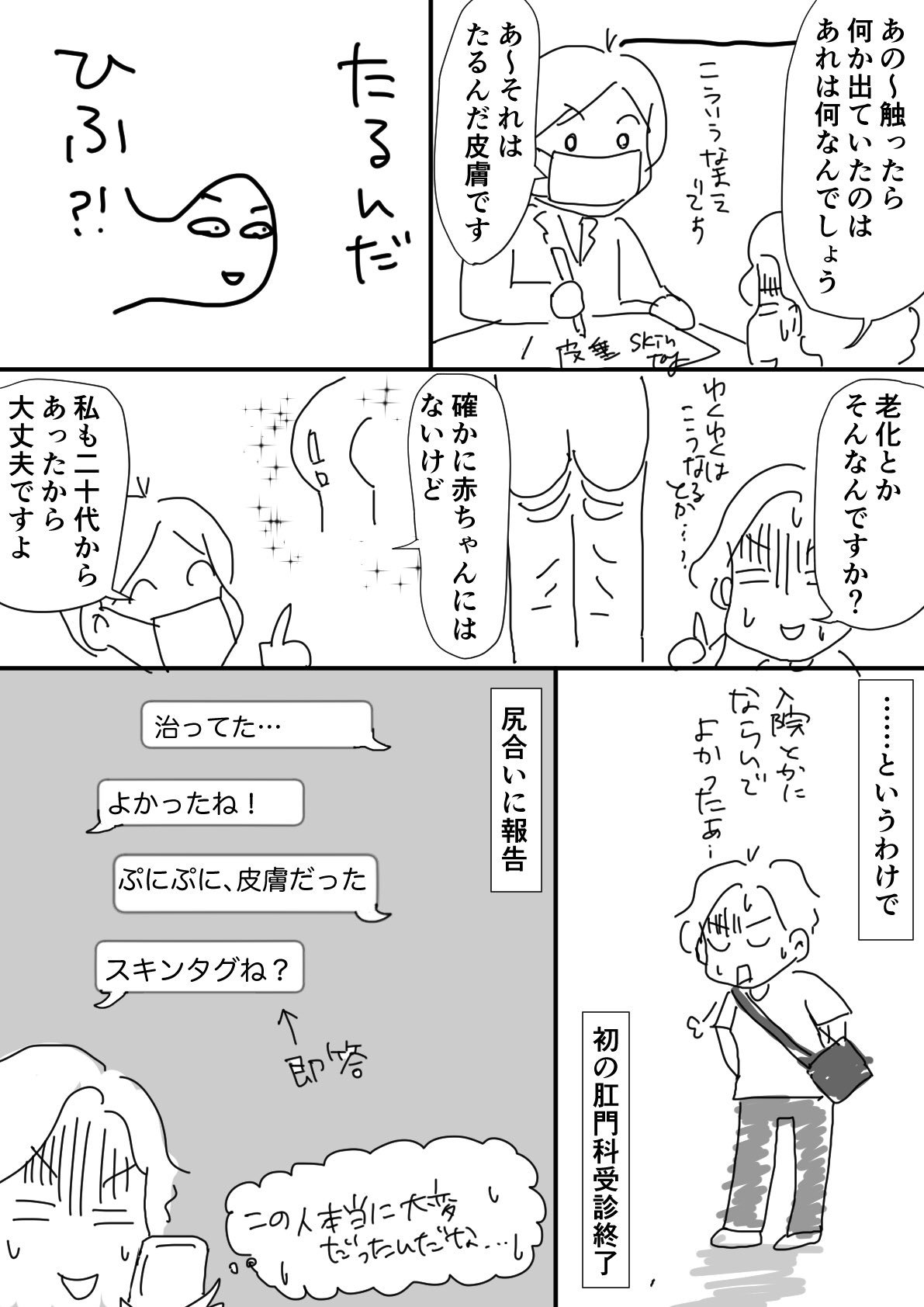 かんべみのり Mbaまんが 痔の疑いのある尻 後編 一箇所訂正したのでアップし直しまする というわけで 血豆と皮膚のたるみでございました かんべみのり Mbaまんが 痔の疑いのある尻 後編 一箇所訂正したのでアップし直しまする というわけで 血豆と皮膚のたるみでございました
