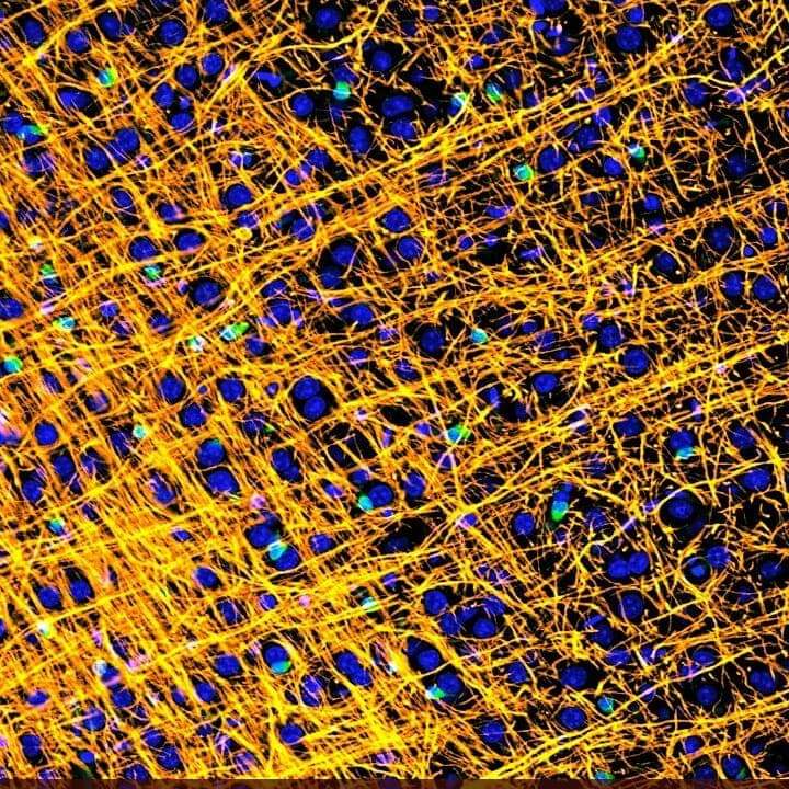ResearchGlia's tweet photo. Our guys attended #MSFrontiers2019 and entered the MS in Focus competition.We are glad to report that their pictures were the public's and the judges' favourites!Congrats @AndreaDomRivera @fpieropan! #MSResearchers #SciArt #UoP @UoP_PharmacyBMS @UoP_IBBS @ButtArthur1 @UoPScience https://t.co/Duuff117DJ