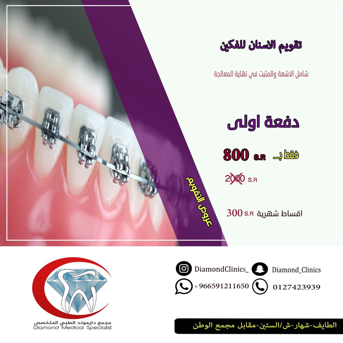 DiamondClinics_'s tweet photo. عروض تقويم الاسنان 
#الطايف_الان #الطايف_من_جديد https://t.co/b2KvyyHWs3
