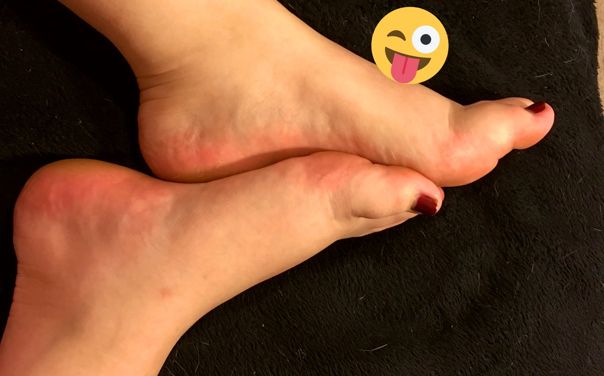 peachysoless's tweet photo. Don’t be afraid to message you pigs 🐷 #feetstagram #FootFetish #sellingfeet #feetfetish https://t.co/Wccu4AW3Ac