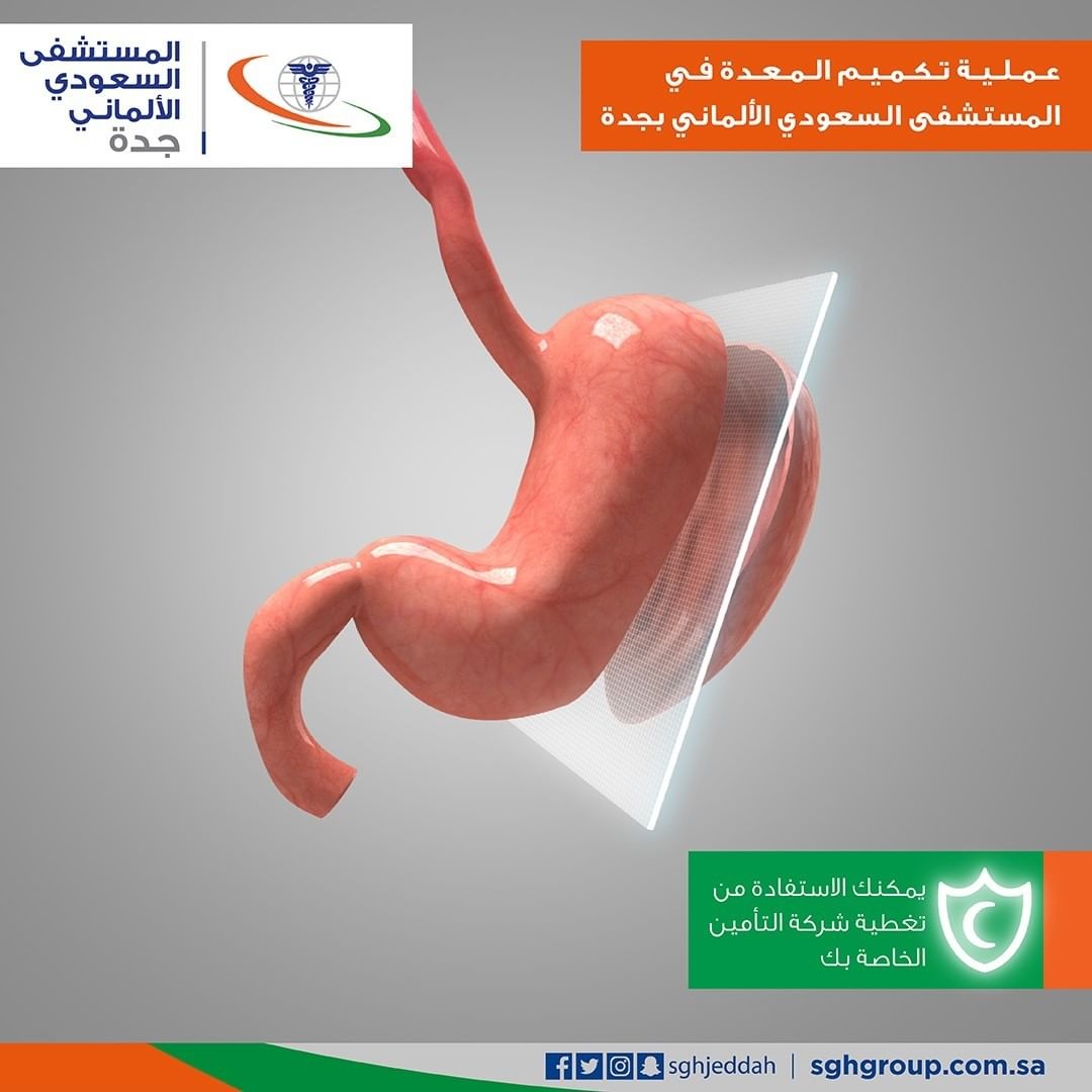 المستشفى السعودي الألماني جدة On Twitter شركات التأمين تغطي عمليات التكميم ولكن هذا يتحدد بعد الزيارة المبدئية للطبيب لأن كل حاله تختلف عن الأخري لذا بعد الكشف يتم ارسال تقارير طبي الي