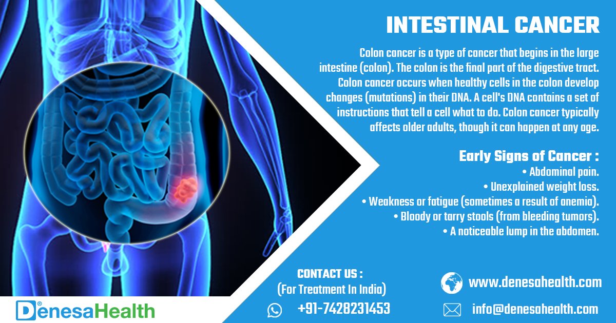 #IntestinalCancer:
It's a type of Cancer that begins in the #LargeIntestine (#Colon).

#SayNoToFastFood #CutOutTheJunk #EatHealthy #Cancer #ColonCancer #Digestive #DNA #BloodyStools #Anemia #MedicalTourism #DenesaHealth #Health #Medicare #Nigeria #Kenya #Ghana #Sudan #Mozambique