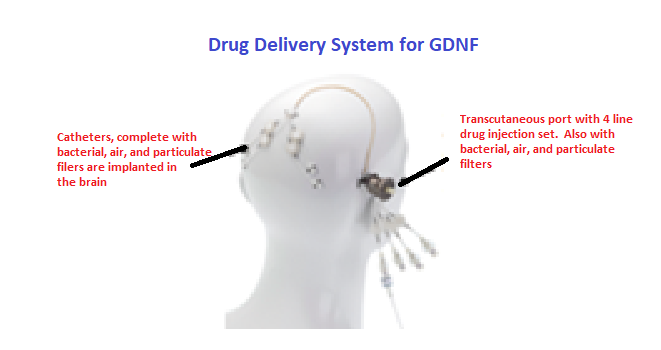RAAckerman's tweet photo. GDNF to the rescue? #braincells #GDNF #glialderivedneurotrophicfactor #medgenesis #Parkinson'sDisease #renishaw #in #blogboost #UBCBlogBoost #adjuvancy https://t.co/HTeIhbFUik https://t.co/SIwNI7qOES