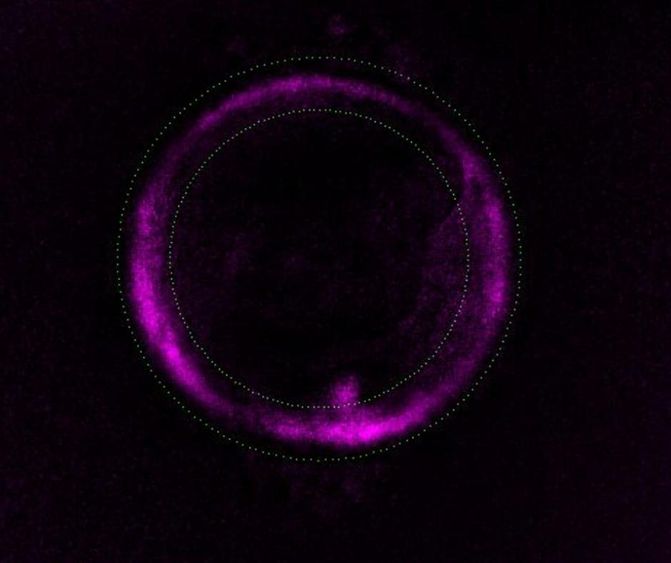 imarques_EN's tweet image. The #PolarizedLightMicroscopy (PLM) allows us to observe the most important structures in the #oocyte to prevent it from getting damaged in the #ICSI process, thus increasing the fertilisation rate. #IVF #Technology #Fertility goo.gl/Xa5Bqz