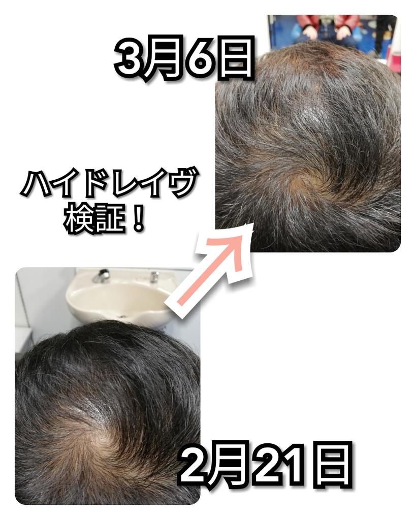ブルーオンピンク
