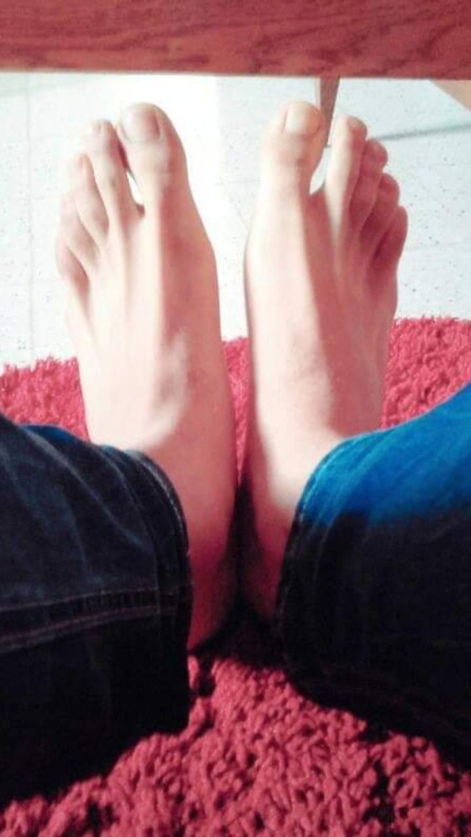 PiesMundo's tweet photo. Sexy feet https://t.co/kY65ei6TrI