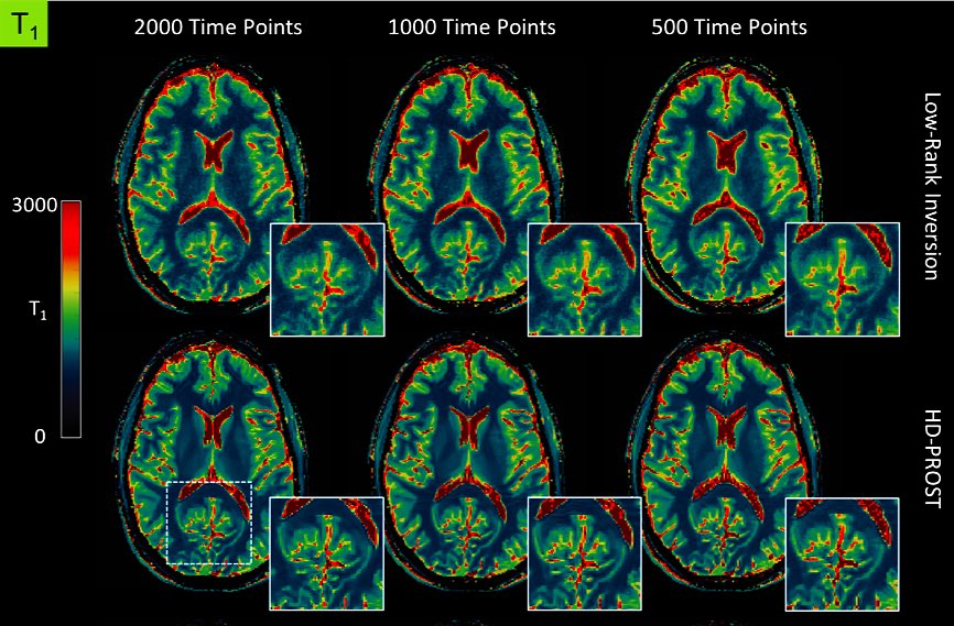 Check out our latest MRM paper on High-dimensionality patch-based reconstruction of multi-contrast MR images (HD-PROST), with applications to MRF and MTC <a href="/KCL_CardiacMR/">KCL Cardiac MRI</a> <a href="/SmartHeartUK/">SmartHeart</a> <a href="/mripapers/">MRI Papers</a> <a href="/quantitativeMRI/">quantitative MRI</a> #MRF #MRI 

onlinelibrary.wiley.com/doi/pdf/10.100…