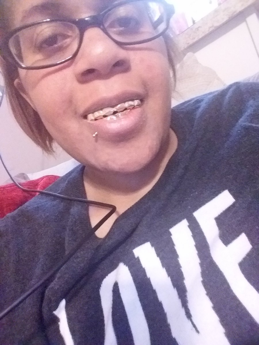 Lewis2ash's tweet photo. These fake grills are so much fun! They are easy to adjust to fit your mouth size and they shine just like real gold. Check them out on Amazon at the link below! #grillz #goldgrillz #hiphopgrillz #blingblowout #hiphopjewelry

https://t.co/l2R3tAHQzp https://t.co/dVr3ukOIqw