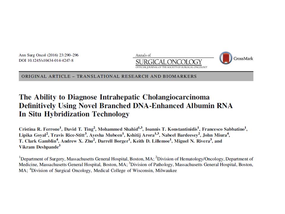 neuthunter's tweet photo. @slusagar Albumin ISH is great, but will be positive in both HCC and intrahepatic cholangiocarcinoma, so not helpful in this setting. I find it most useful in distinguishing intrahepatic cholangiocarcinoma from a metastatic adenocarcinoma to the liver. https://t.co/zAJGViBm9f