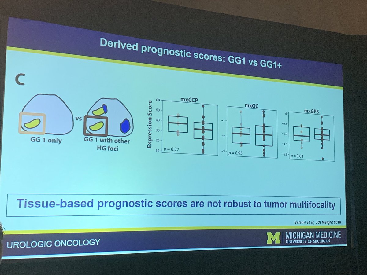 UroOncJT's tweet photo. Genomic testing NOT robust to tumor multifocality.

That is a bummer, and consistent with previous findings (e.g. Wei et al Eur Urol 2016).

@samsimsal summarizing some of his great work. #PCPR19 https://t.co/QjqwLhpk8Z
