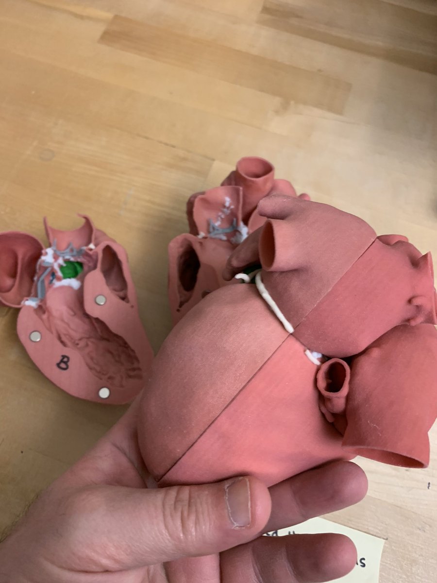 JayMorris_MD's tweet photo. When #3Dprinting multiple color parts on thr #projet660 build orientation, how long binder has been sitting & #color software optimization are all important. We often print multiple versions of patients models. Good #Service contracts are key. Thanks @3dsystems for helping https://t.co/Gr3WokaTTe
