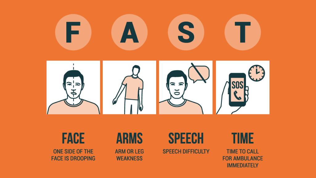 HHSGov's tweet image. Know the signs and symptoms of stroke –use these signs to act F.A.S.T.: bit.ly/2XBkd29