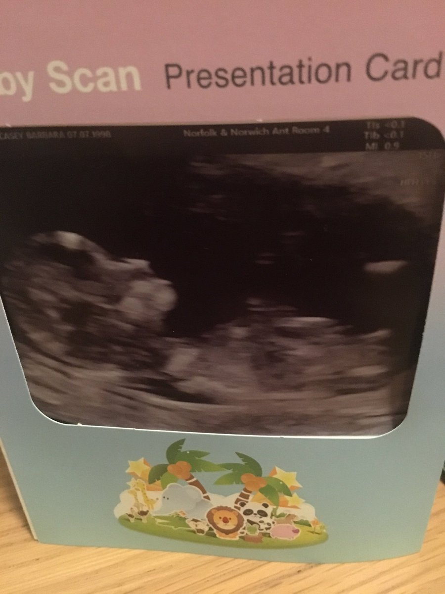 ScarffMel7373's tweet photo. @Pink @TheEllenShow #mondayblues #broughtpinkticetsbutcsntgo #1stchilddue https://t.co/hKwCeT8IMA