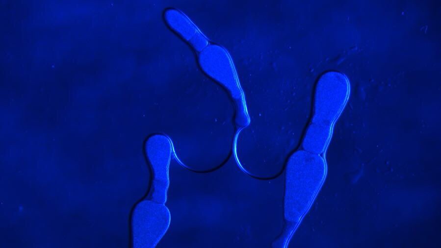 EszLab's tweet photo. #microlife in #coleoptera midgut
• Gregarine syzygy

#symbionts #protozoa #microorganisms #gutmicrobiome #diversity #labtime https://t.co/HV8AX6UAmp