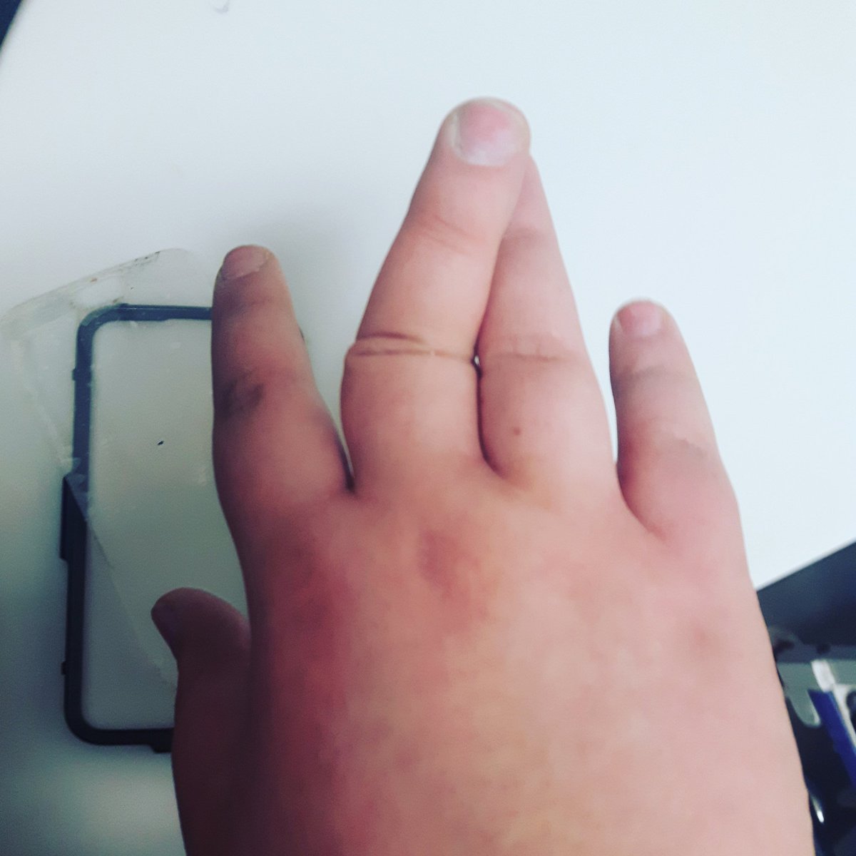 Abslice1973's tweet photo. Done fucked up my finger https://t.co/IqoQ8lXlJo