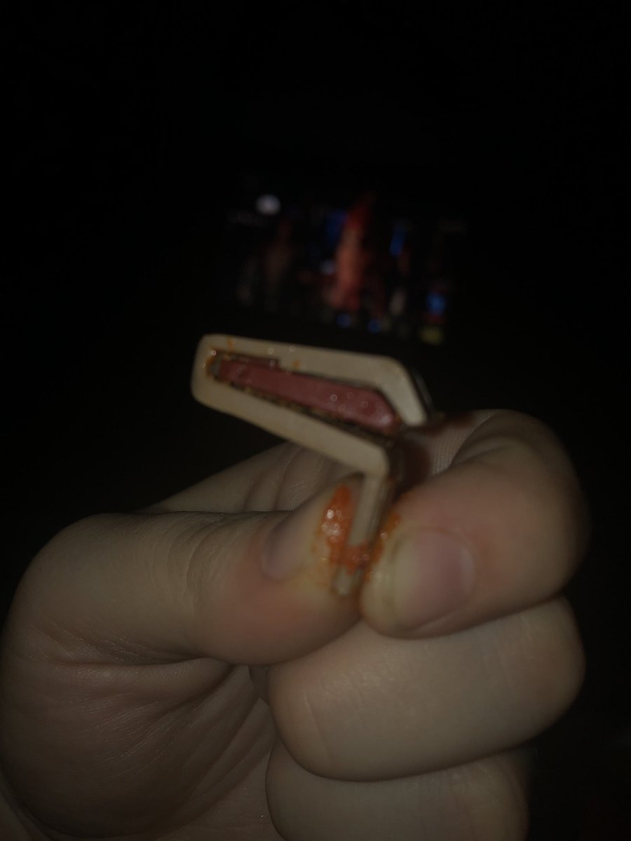 HannahScott3's tweet photo. @Fritolay @Doritos this was in my bag of Doritos! As I went to take a bite of what I thought was some chips, I bit down on this! What the heck!!! https://t.co/sJ4bnme0cS