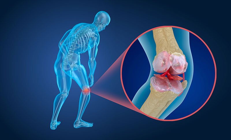 brain_2020's tweet photo. Cartilage Regeneration in Osteoarthritic Patients by a Composite of Allogeneic Umbilical Cord BloodโDerived #Mesenchymal #Stem_Cells & Hyaluronate #Hydrogel.
Attend Tissue Science 2019 https://t.co/0Fqvbp2l5T
#Bioimplants #Cartilage_regeneration @CartilageRepair @BU_Tweets @MIT https://t.co/gXj46pyXma