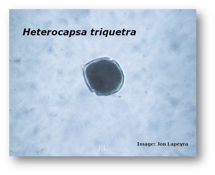mixotrophs's tweet photo. Some pictures of #mixotrophs for you to enjoy, courtesy of #ESR 10 @JonLapeyra from @ULBruxelles, sampled from the North Sea. #Alexandrium tamarense, #Heterocapsa triquetra and #Protocentrum micans. #MixITiN #ITN @MSCActions @EU_H2020 #protist #plankton #marine https://t.co/TShbemioqq