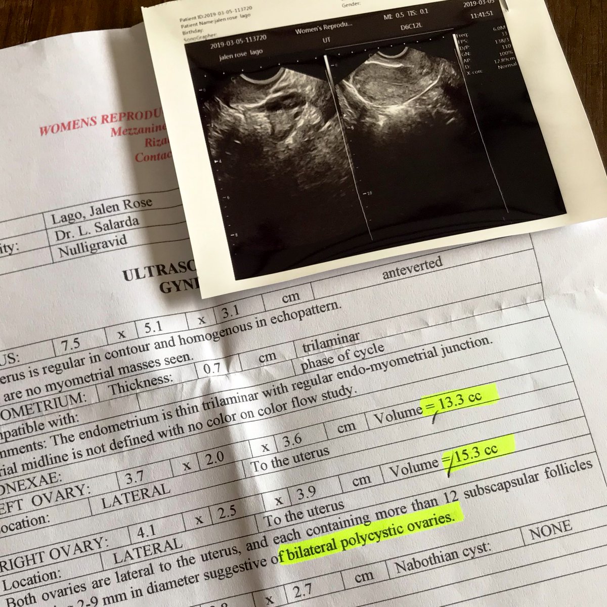 tweety_jalz's tweet image. “Don’t ever let fear hold you back.”
#FightPCOS