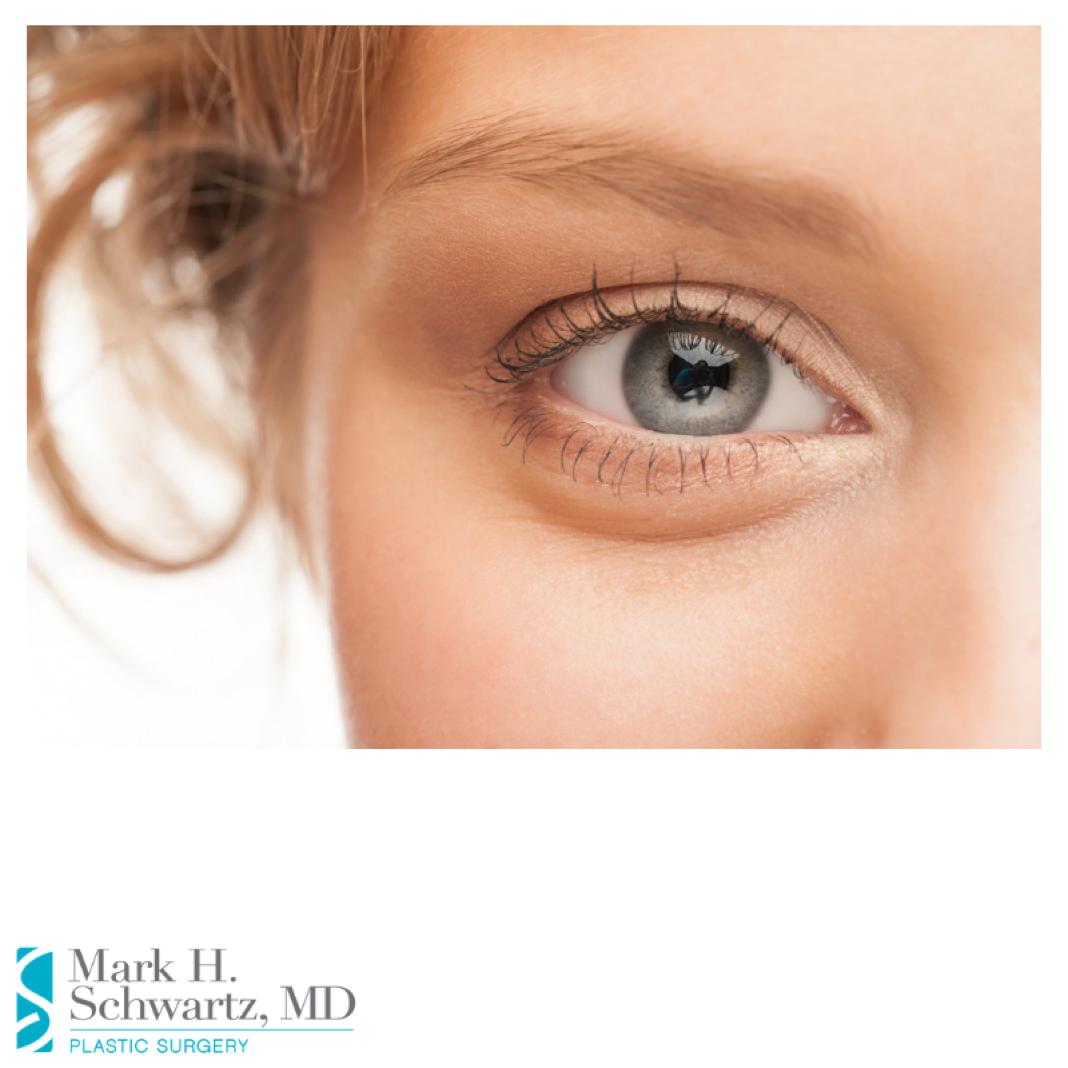 To successfully revitalize eyelids and the skin around the eyes, Dr. Schwartz will use a delicate comprehensive approach to address fine lines, wrinkles, excess fat and skin, and dark circles. #AskDrSchwartz