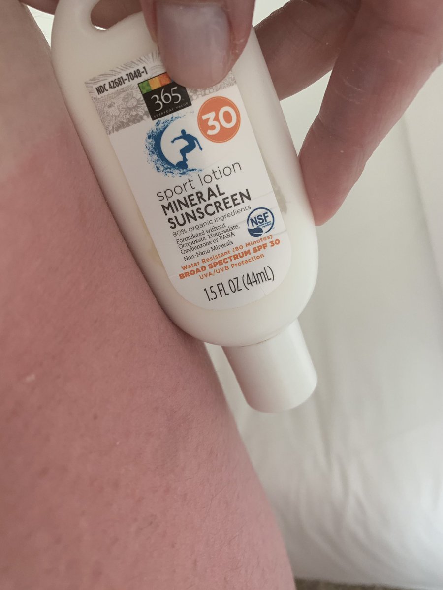 CoolAsACuke5's tweet photo. @WholeFoods bought your 365 mineral based sunscreen and where I used it I got burned!  Take it off the market https://t.co/mt00a9elAn