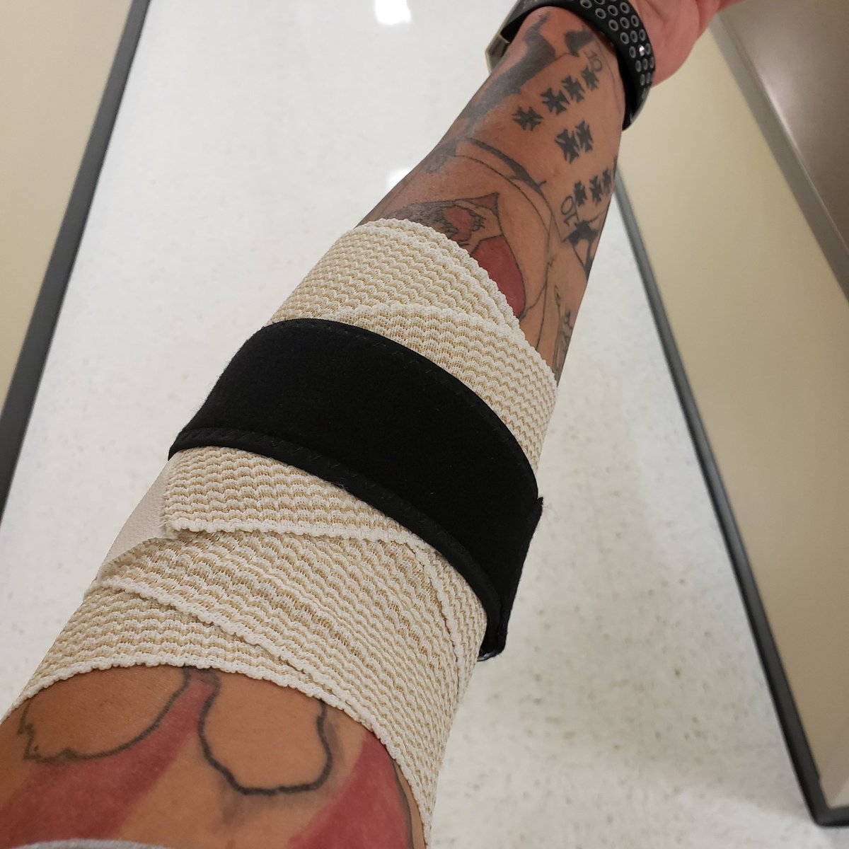 Got PRP injections in my elbow today. Hoping it does the trick and surgery won't be needed.