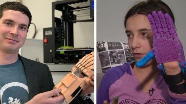 3dheals's tweet photo. 3D printing firm trying to help Alberta girl develop prosthetic hand has hit a snag @CBC #3dprinting #prosthetic #biomedical_engineer #technology #innovation #JointheTribe https://t.co/5ClkODfBdg https://t.co/RuTSR5shXR https://t.co/0esCa5drEj