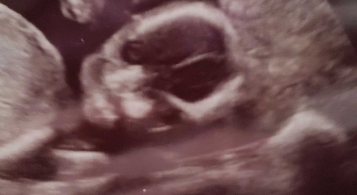 Ryn, Goddess of Blankets tweet media