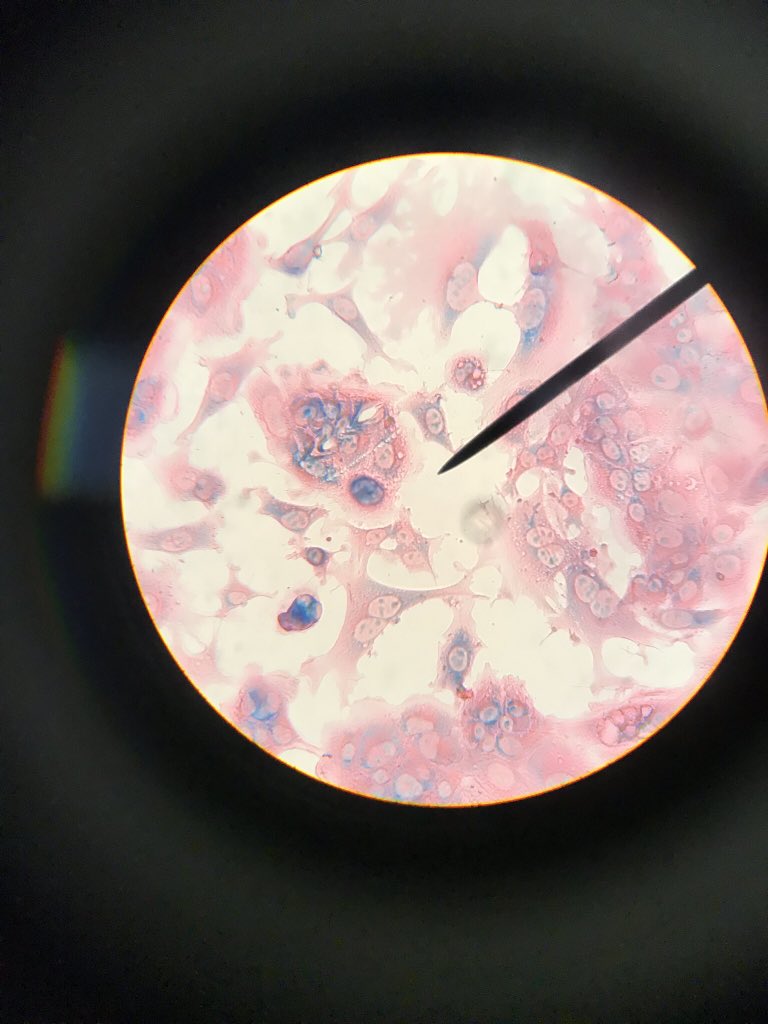 erikabennett00's tweet photo. @UNKBiol106AC #106Week9ACS19 looking at mitosis https://t.co/LicyZLqbWu