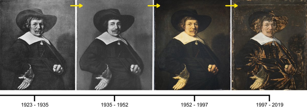 DIADetroit's tweet photo. As part of #BringBackJanHals, we’ll be posting updates about “Portrait of a Man,” by Jan Hals from 1644. This timeline shows how the painting has changed. The original paint was damaged in 1935 during a clumsy treatment. This old damage was revealed in the most recent treatment. https://t.co/4BhtlK2Bf4