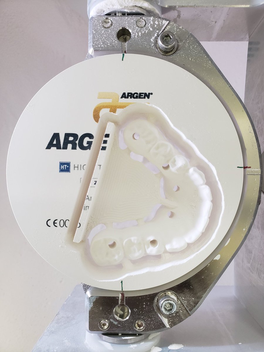 Argen_Corp's tweet photo. A beautiful ArgenZ HT+ Pre-Shaded smile courtesy of the talented Kojo Hayford, RDT of Dental Laboratory Associates. Thanks for sharing this fantastic case!
#ArgenCorporation #ArgenZ #DentalZirconia #DentalTechnician https://t.co/gTD4MGhteg