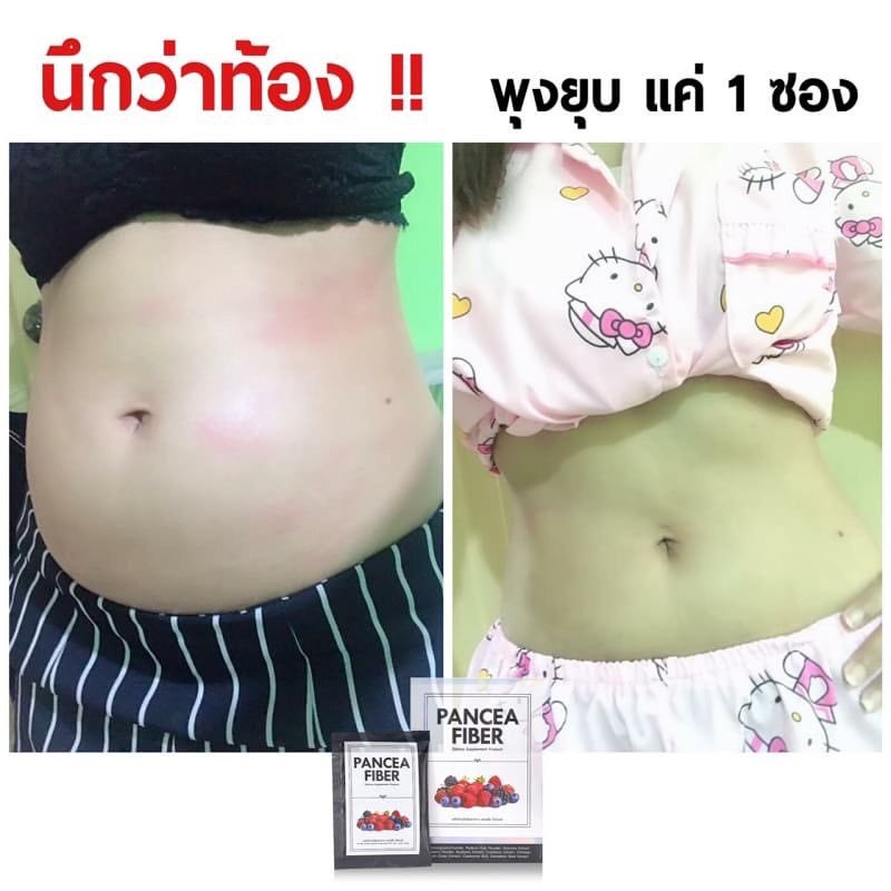 kamyuibakery_17's tweet photo. Party หนัก ดื่มหนัก เที่ยวหนัก 🍺🍷 #ฉันจะผอม
อย่าลืมดูแลตัวเอง ‼️

Detox ปรับสมดุล ร่างกาย
ขับของเสียสะสมในร่างกายให้สุขภาพดี #ฉันจะสวย ❤

1 ซองก่อนนอน อาทิตย์ละ 2-3 ครั้ง 
#PANCEAFIBER #WINKWHITE
#howtoperfect

สั่งซื้อสมัครตัวแทน #winkwhite ได้ที่👉🏻https://t.co/VPXBtXQIGf https://t.co/JLqI3TTog9