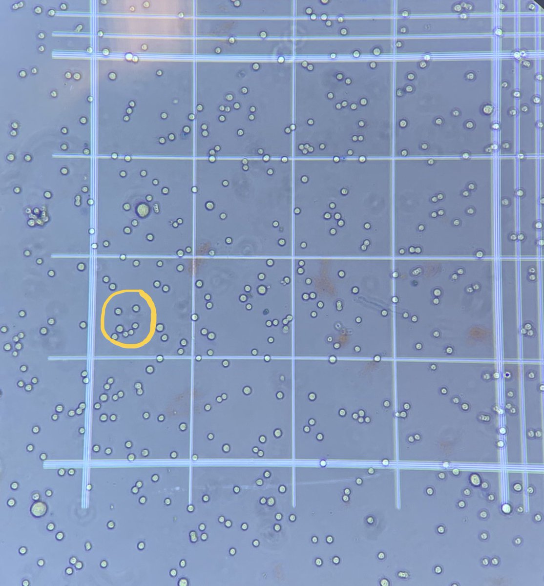 DrMeganKelly's tweet photo. I truly dislike counting cells, but when they give you a goofy smile... nah what am I saying, it still isn’t fun. https://t.co/irSqdEuygd