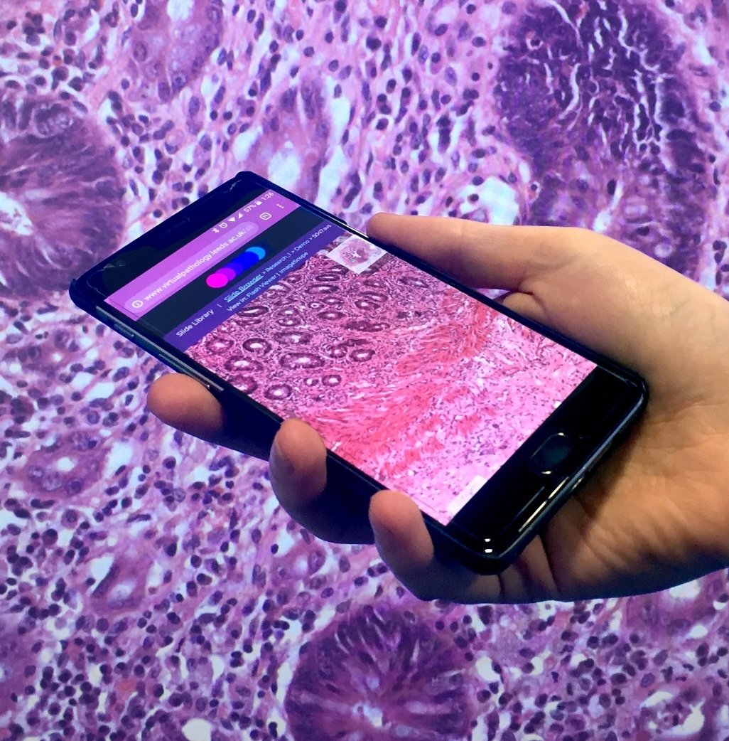 LeedsPathology's tweet photo. On a train or bus this morning? Why not have a cheeky glance at some digital path on the go with our new slide viewer...optimised for on go pathology! Just head over to the website....www.virtualpathology.leeds.ac.uk https://t.co/asPzhDatae