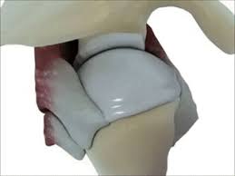 Stemcellmeet's tweet photo. An increased propensity of stem cells within with rotator cuff muscles to develop into fat cells https://t.co/qV7z7NkgOn  
#stemcell_congress #stemcell_conferences #regenerative_medicine #regeneration #stemcells https://t.co/B5E8UohcsW