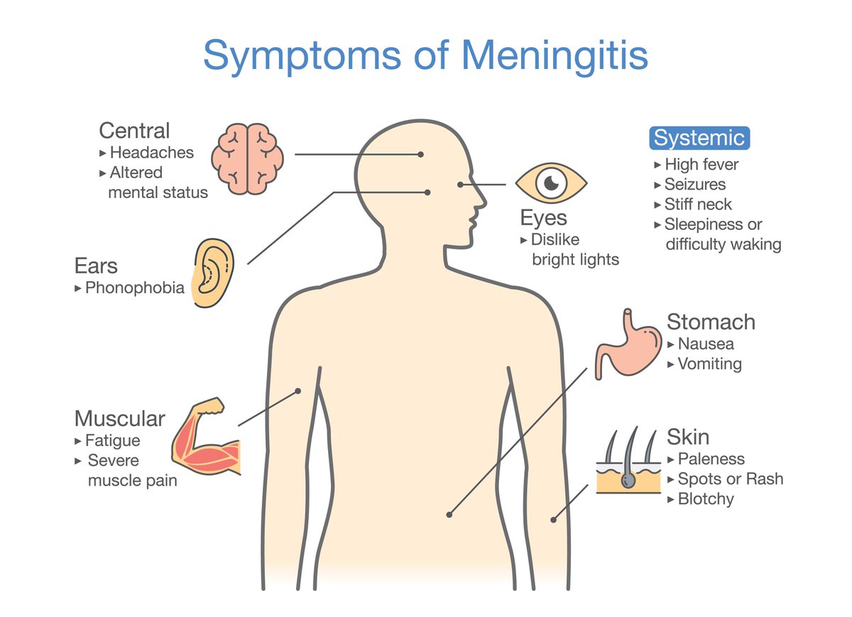 NeurosciScience's tweet photo. Meningitis is an inflammation of the meninges. The meninges are the three membranes that cover the brain and spinal cord. Meningitis can occur when fluid surrounding the meninges becomes infected.https://t.co/Ono1C50tR0 https://t.co/MkB5TPsHtd