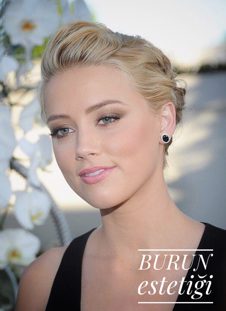 ⭕️Burun estetiği ameliyatlarında amaç, sadece estetik güzellik değil aynı zamanda burnun içindeki yapısal problemlerden kaynaklanan tıkanıklıkların ortadan kaldırılması ve hastanın daha rahat nefes almasını sağlayabilmek..💫

#serdarborabayraktaroglu #clinicsbb #burunestetiği